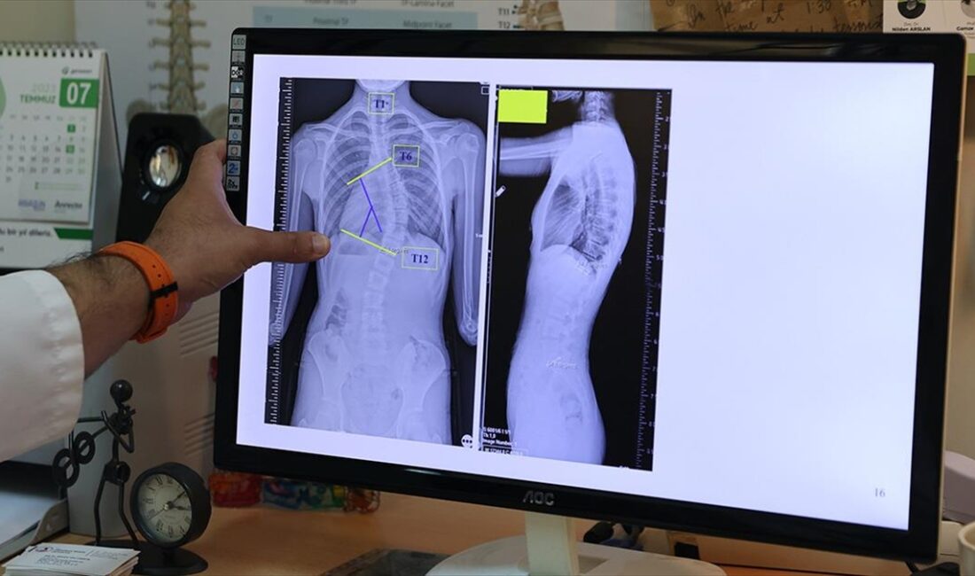 Ondokuz Mayıs Üniversitesi (OMÜ) Tıp Fakültesi Ortopedi ve Travmatoloji Anabilim
