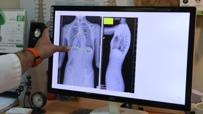 Ondokuz Mayıs Üniversitesi (OMÜ) Tıp Fakültesi Ortopedi ve Travmatoloji Anabilim