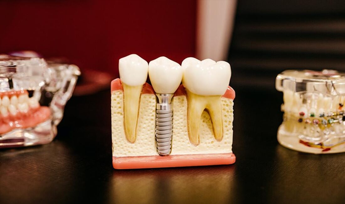 Dental turizmin 2023 beklentisi 300 milyon dolar İstanbul Diş Hekimleri Odası Denetleme Kurulu Doç. Dr. Cenker Koyuncuoğlu,