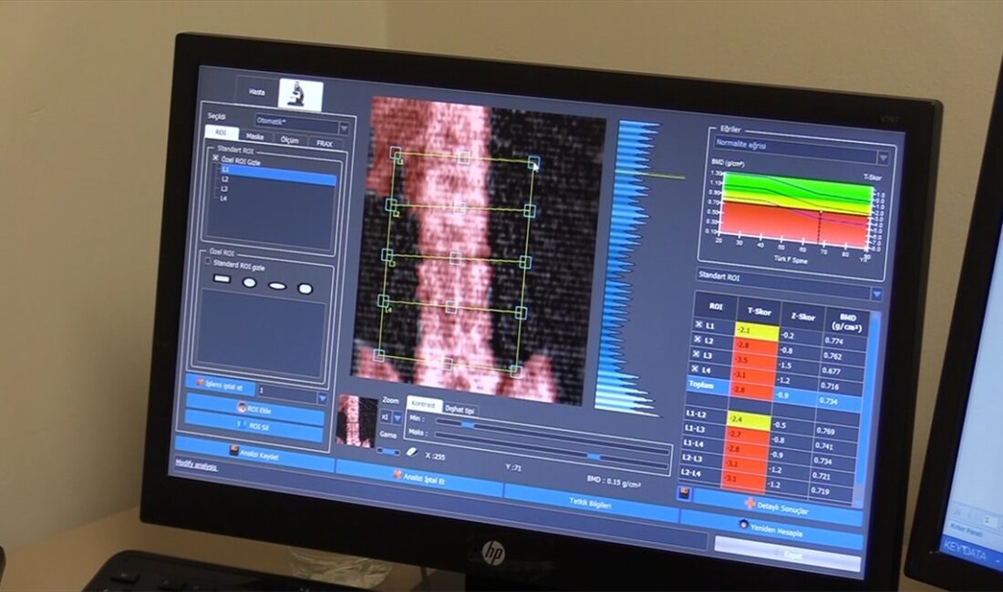 Kayseri Şehir Hastanesinde ağustos ayında hizmete açılan osteoporoz polikliniğinin doktorları,