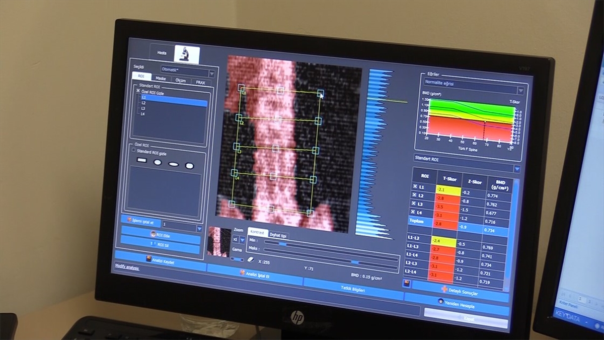 Kayseri Şehir Hastanesinde ağustos ayında hizmete açılan osteoporoz polikliniğinin doktorları,