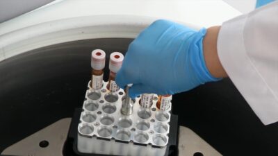 Türk Hematoloji Derneği İkinci Başkanı Prof. Dr. Şule Ünal Cangül,