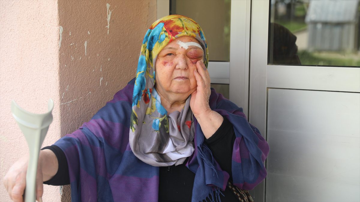 Edirne'de sahipsiz köpeklerin saldırısından kaçarken düşen yaşlı kadın yaralandı. 75