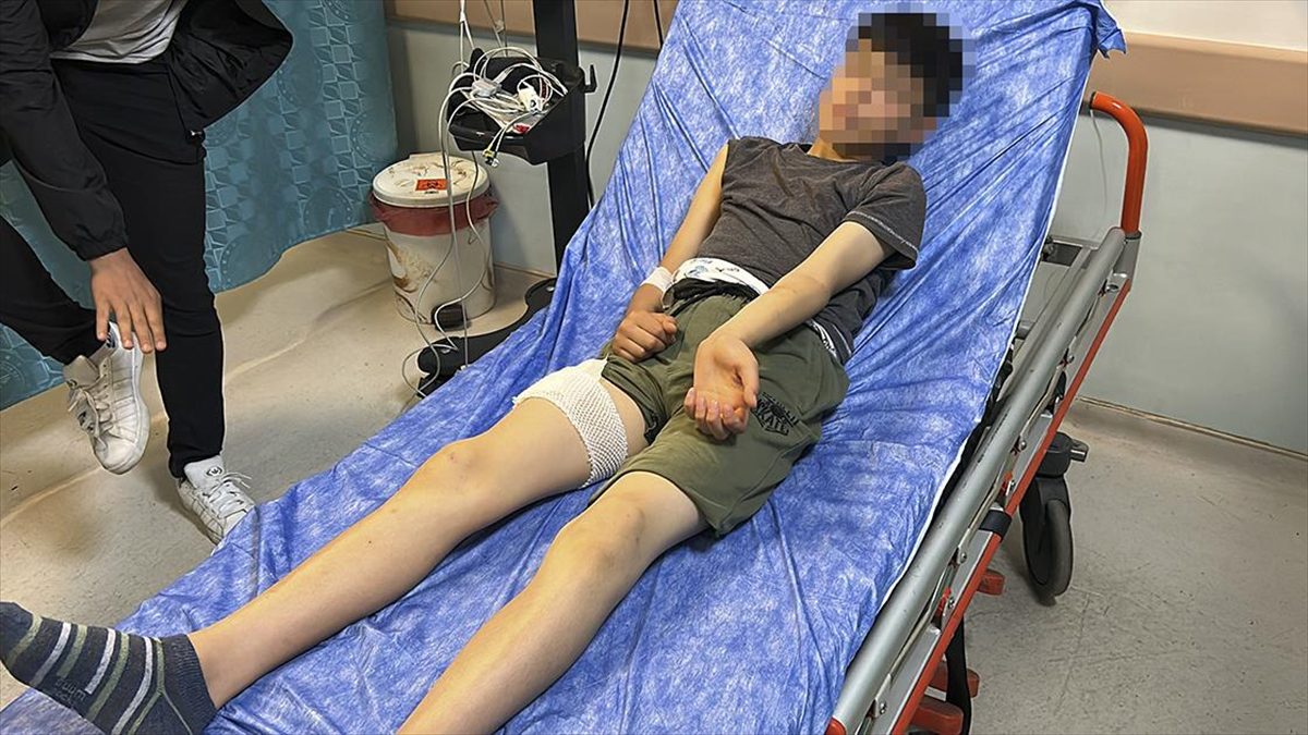 Sivas'ta sahipsiz köpeğin saldırısına uğrayan 13 yaşındaki çocuk yaralandı.