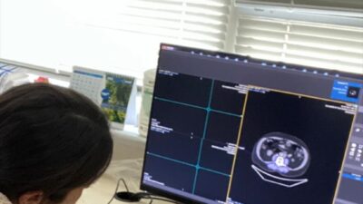 İSTANBUL (AA) – Altınbaş Üniversitesi, akciğer kanserinde yapay zekayla erken