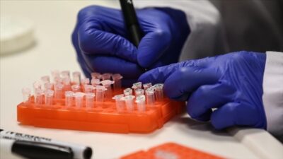 Dünya Sağlık Örgütü (DSÖ), M çiçeği (mpox) virüsünün dünya genelinde