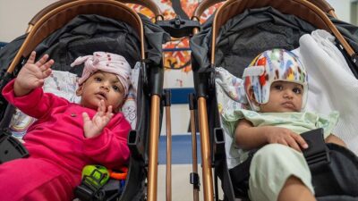 Cumhurbaşkanı Erdoğan'ın talimatıyla Pakistan'dan Türkiye'ye getirilen, başlarından yapışık 8 aylık