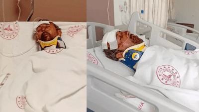 Antalya’da babasının hayatını kaybettiği kavşakta geçirdiği trafik kazasında yaralanarak hastanede